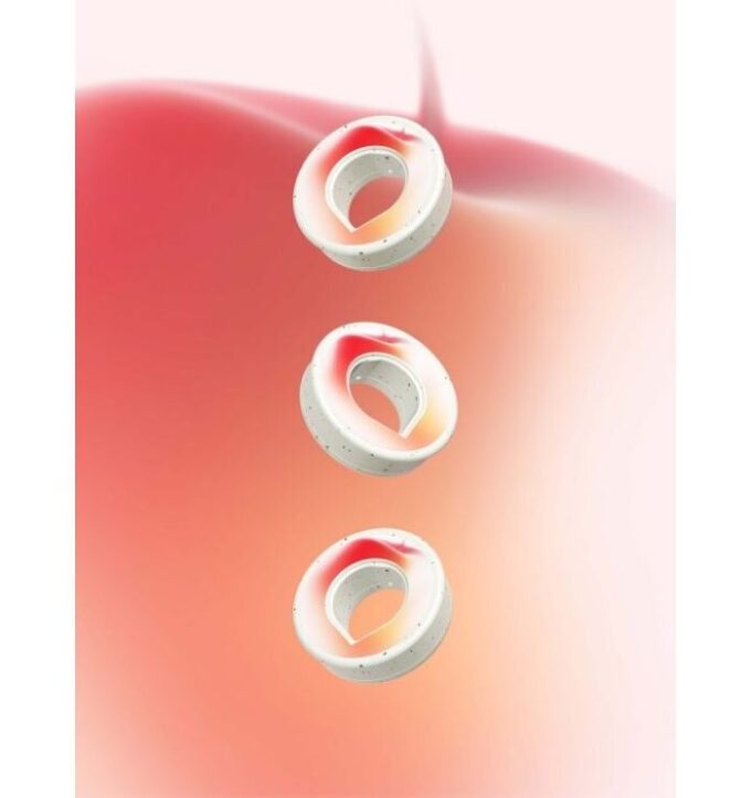 Apple Pods Apple Pods